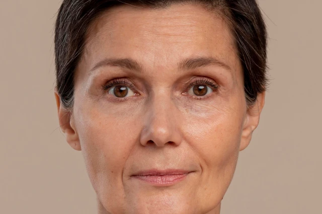 قبل از درمان BeautiDerm