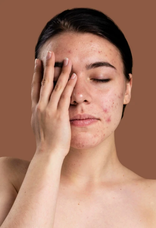 جراحی‌های تخصصی پوست BeautiDerm