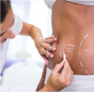 فرمدهی بدن در کلینیک وِنیس